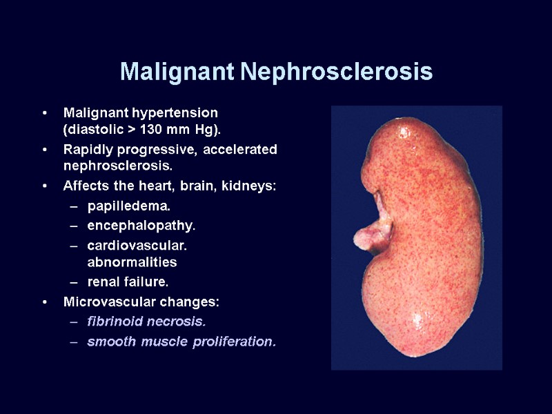 Malignant Nephrosclerosis Malignant hypertension (diastolic > 130 mm Hg). Rapidly progressive, accelerated nephrosclerosis. Affects